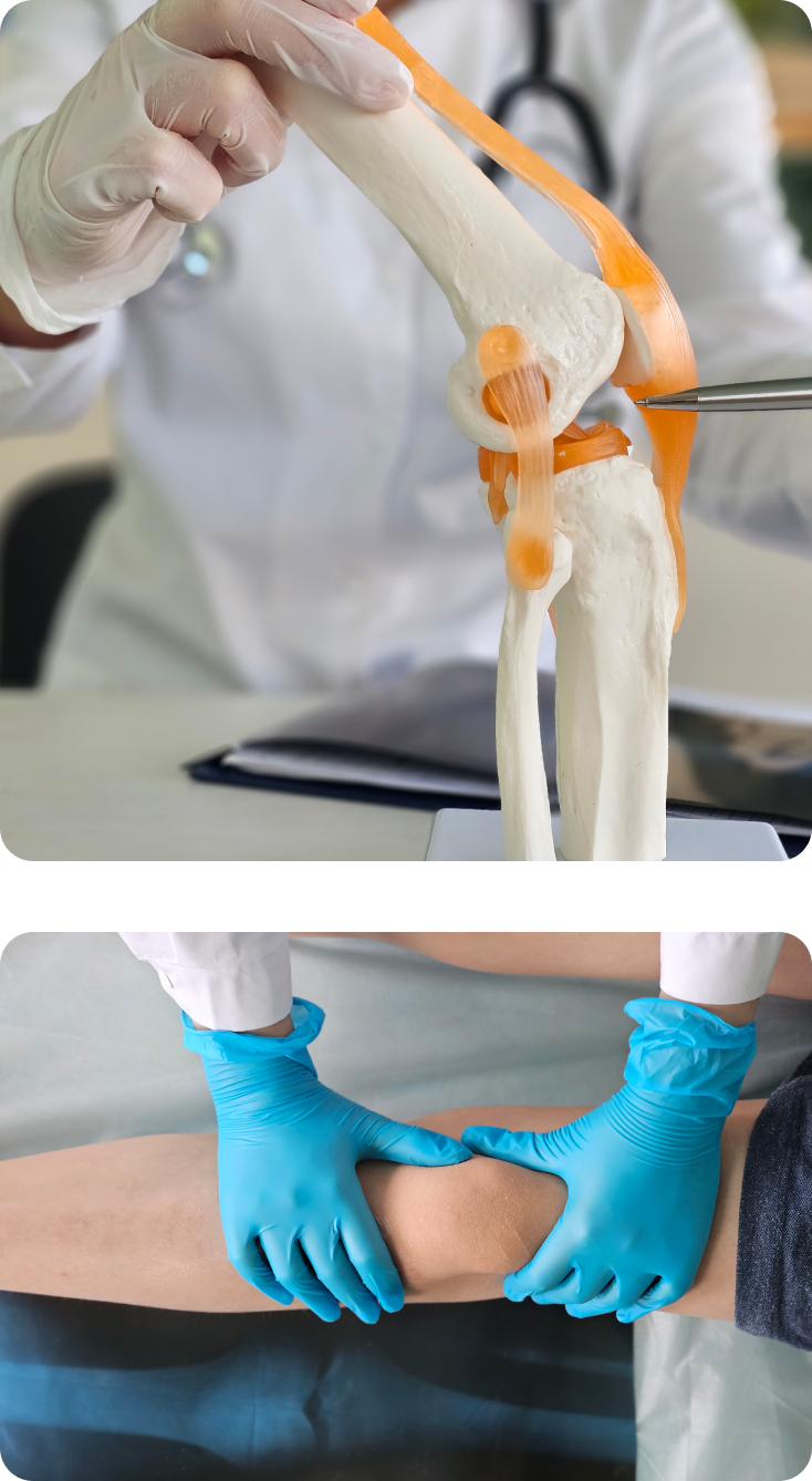 Why Kinematic Alignment